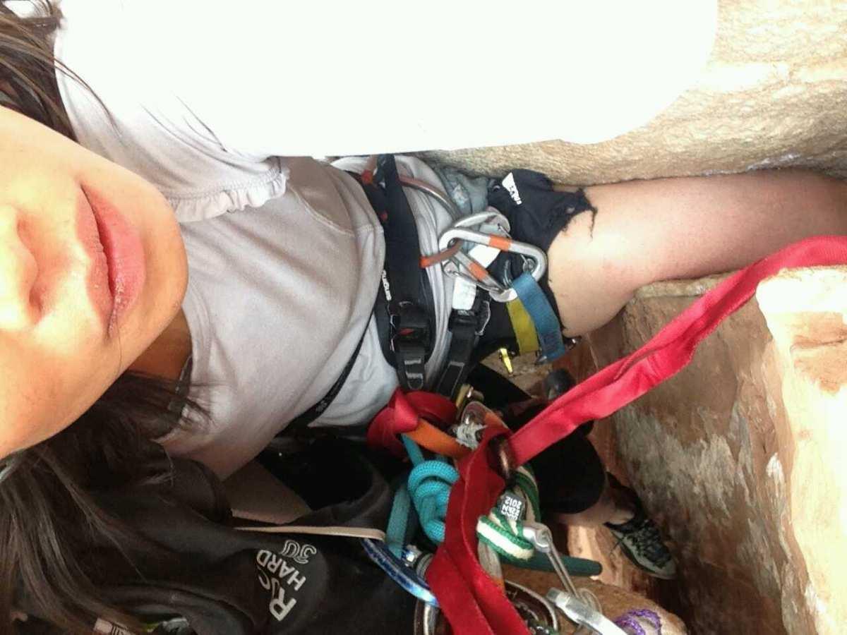 Close up of the patient with leg stuck in the crack