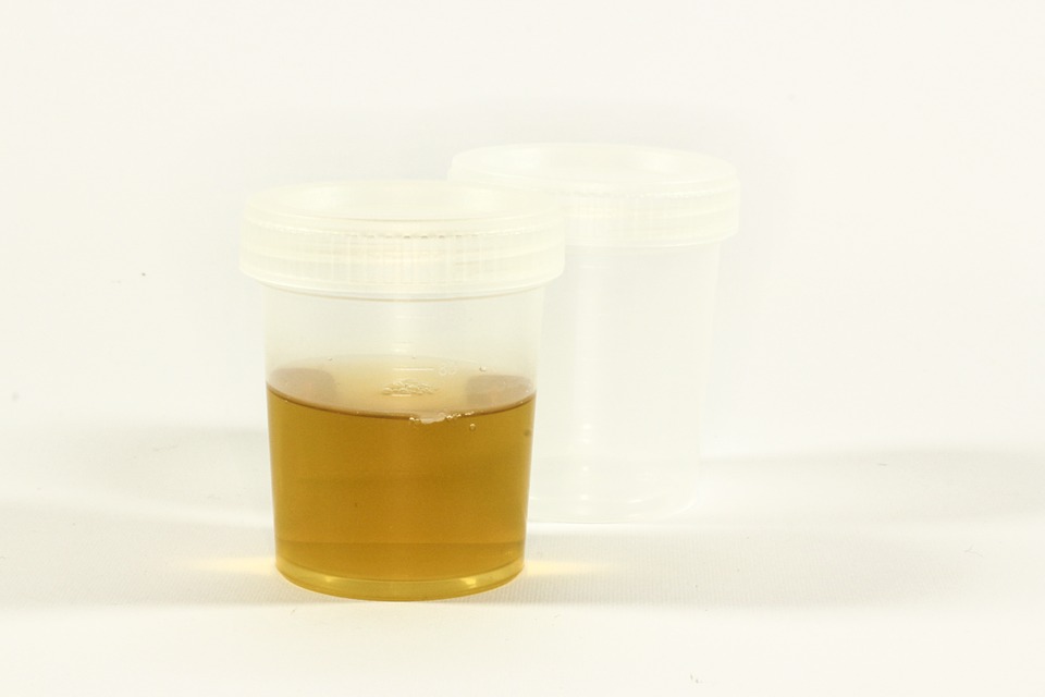 Urine Container Urine Inflammation The Test