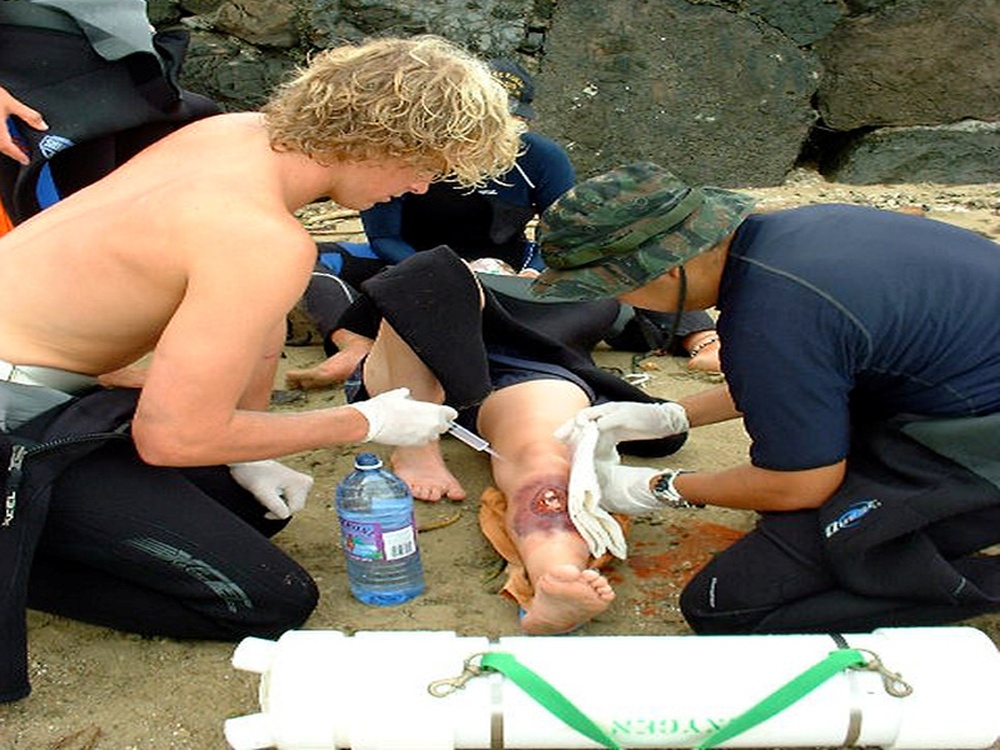 WMI Scenario Leg Irrigation